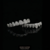 Iced-Out Moissanite Grillz Set
