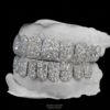 Perm Cut Iced Out Diamond Grillz