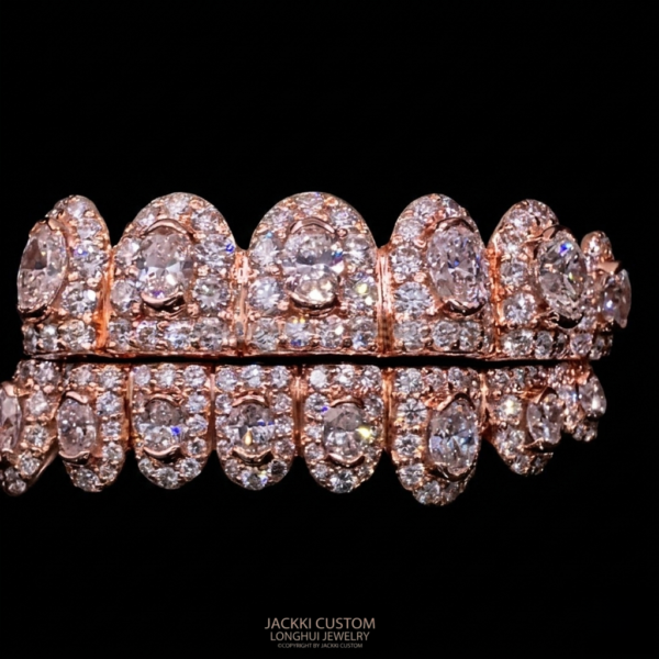 Permanent homeymoon grillz Custom