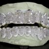 Invisible Set VVS Moissanite Grillz